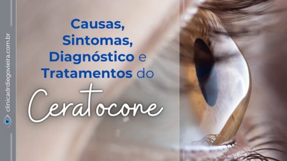 O que é Ceratocone? Causas, Sintomas, Diagnóstico e Tratamentos